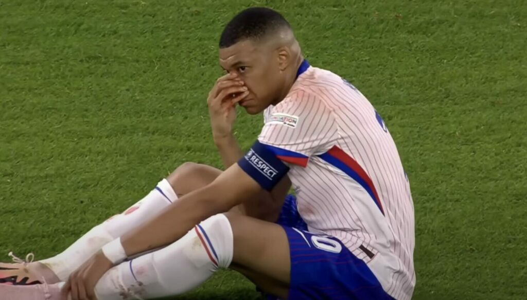 Mbappé le nez cassé